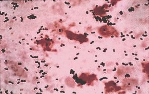 Streptococcus-agalactiae