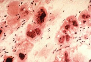 Streptococcus-pneumoniae